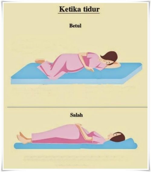 Silap Tidur Punca Janin Mati ... Ibu Hamil Ambil Perhatian