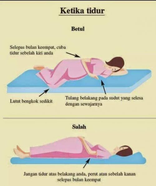 Silap Tidur Punca Janin Mati , Ibu Hamil Ambil Perhatian